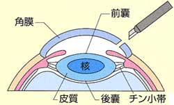 光干渉断層計（OCT）